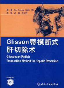 Glisson蒂橫斷式肝切除術 Glisson蒂橫斷式肝切除術