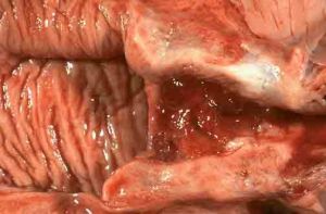 《傅青主女科》