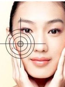 褐青色痣 褐青色痣