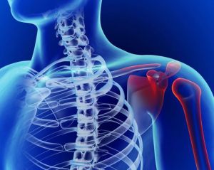 肩部勞損 肩部勞損