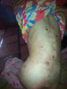 8·3廣東尼姑虐待女童案件 8·3廣東尼姑虐待女童案件