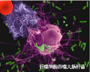 高致病性禽流感病毒感染