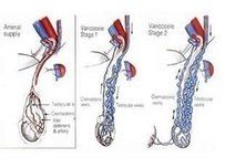 睪丸萎縮 睪丸萎縮