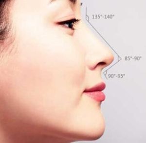 複雜鼻尖整形術 複雜鼻尖整形術