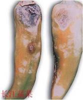 間型刺盤孢 間型刺盤孢