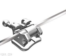 自鎖托槽矯正技術 自鎖托槽矯正技術