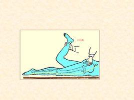 股神經痛 股神經痛