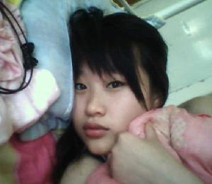 亨廷頓病性痴呆