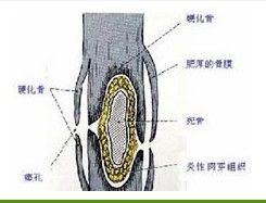 慢性化膿性骨髓炎