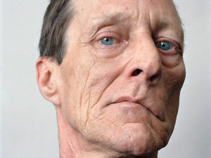 面神經四維離子導入療法 面神經四維離子導入療法