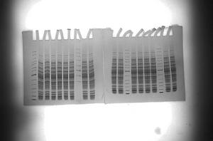 電泳條帶 電泳條帶