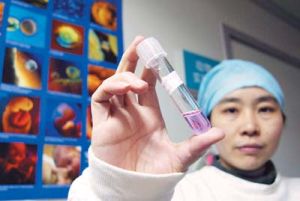 體外養卵 體外養卵