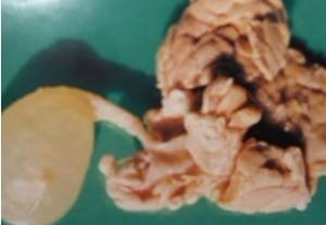 細頸囊尾蚴病 細頸囊尾蚴病