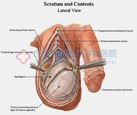 腹腔鏡下高位隱睪下降術 腹腔鏡下高位隱睪下降術