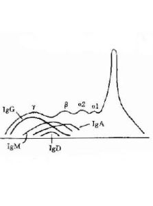 血清蛋白電泳 血清蛋白電泳