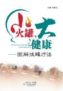 小火罐,大健康——圖解拔罐療法 小火罐,大健康——圖解拔罐療法