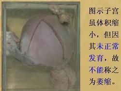 始基子宮 始基子宮