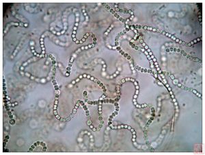 巨大粘球藻 巨大粘球藻