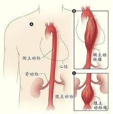主動性充血 主動性充血