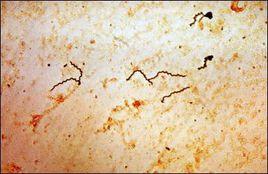 梅毒螺旋體制動試驗 梅毒螺旋體制動試驗