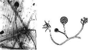 匍匐犁頭霉 匍匐犁頭霉