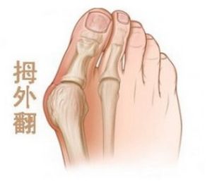 韓式精雕微孔塑形術