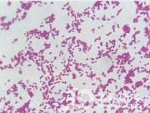 醋酸鈣不動桿菌 醋酸鈣不動桿菌