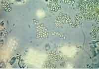 綠硫細菌