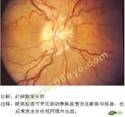 高山紅細胞增多症 高山紅細胞增多症