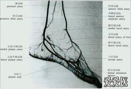 下肢動脈造影 下肢動脈造影