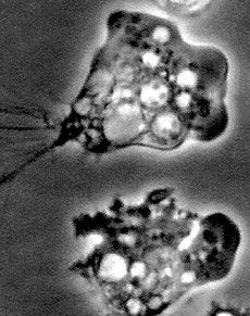 阿米巴原蟲病 阿米巴原蟲病