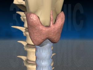 甲狀腺囊腫 甲狀腺囊腫