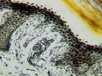 觸覺小體 觸覺小體