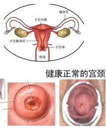 宮頸 宮頸