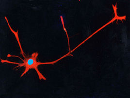 神經幹細胞 神經幹細胞