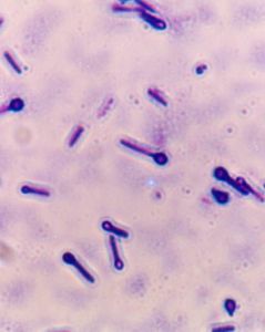 厭氧性細菌 厭氧性細菌