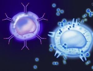聯合免疫缺陷病 聯合免疫缺陷病