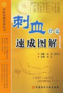 刺血療法速成圖解 刺血療法速成圖解