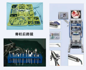 “雙鏡一影”綜合治療體系 “雙鏡一影”綜合治療體系