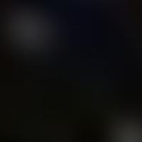 IC 949 RASS 彩色圖