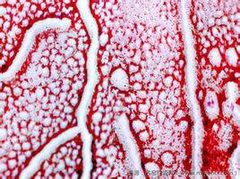 蚯蚓走泥紋 蚯蚓走泥紋