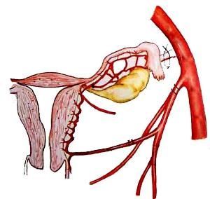 卵巢動脈 卵巢動脈