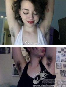 曬體毛運動 曬體毛運動