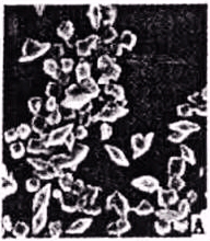 （圖）蘇雲金桿菌：