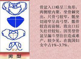男型骨盆 男型骨盆