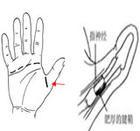 大拇指腱鞘炎 大拇指腱鞘炎