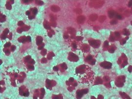 革蘭染色 革蘭染色