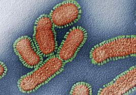 炭疽病毒 炭疽病毒