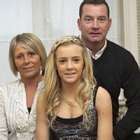 科凱恩氏綜合徵 科凱恩氏綜合徵