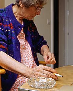 帕金森病性痴呆